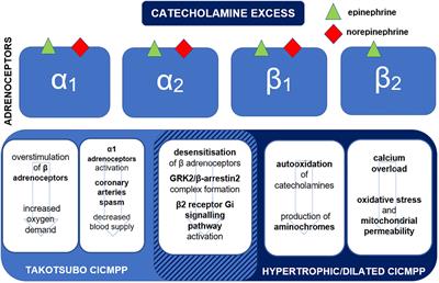 Pheochromocytoma/paraganglioma-associated cardiomyopathy